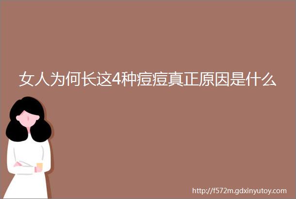 女人为何长这4种痘痘真正原因是什么